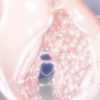 Thumbnail of related posts 030